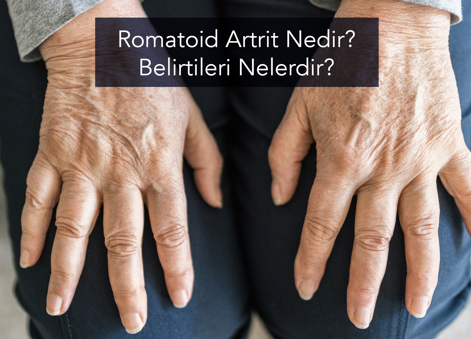 Romatoid Artrit Nedir